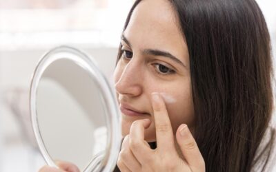Understanding Acne: Myths and Facts